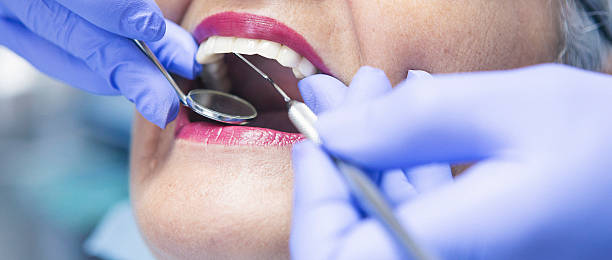 Best Emergency Dental Care for Abscessed Tooth in Grambling, LA